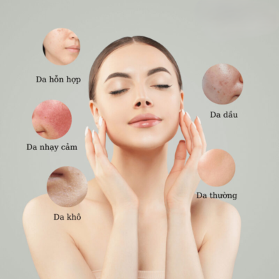 Có 5 loại da cơ bản phổ biến nhất