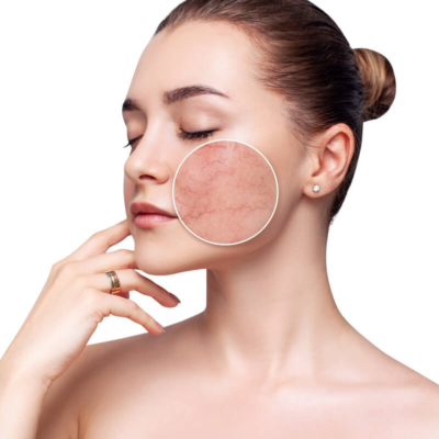 Những cách chăm sóc da nhạy cảm hữu ích