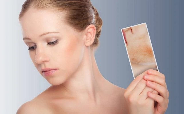 Hướng dẫn cách chăm sóc da mặt bị dị ứng nhanh chóng và an toàn