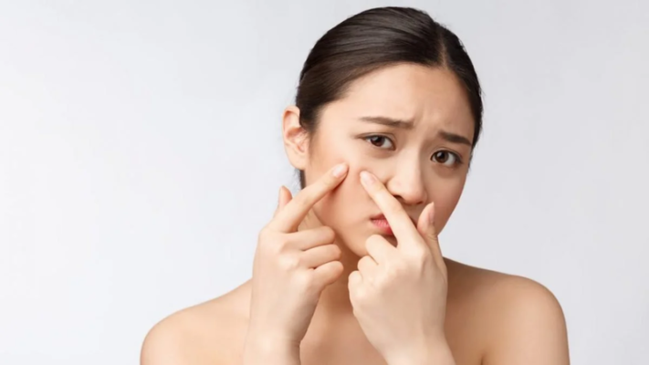 4 cách chăm sóc da mặt bị mụn ẩn tại nhà ai cũng nên biết