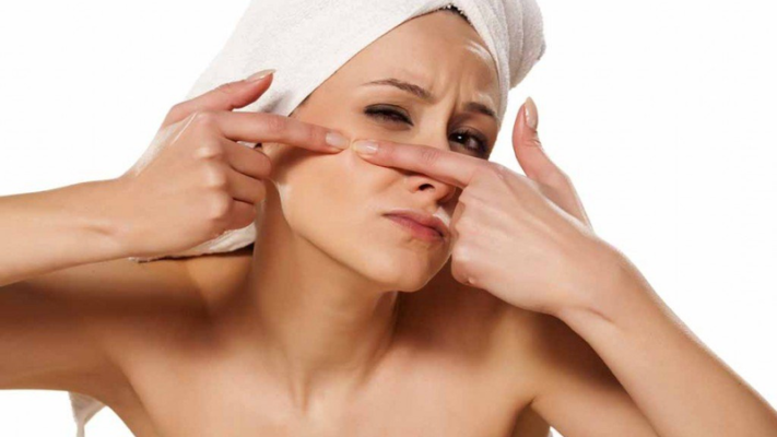 Các cách chăm sóc da mụn đầu đen để loại bỏ chúng nhanh chóng